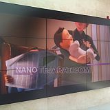 ویدئو وال 9 خروجی ویدئو وال 9 خروجی